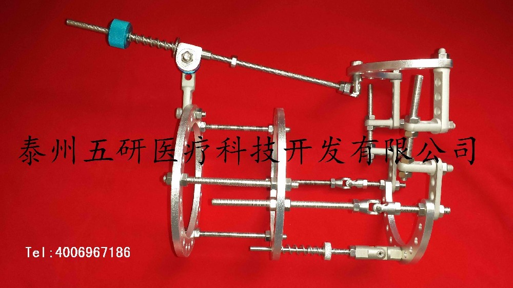 Ilizarov外固定架